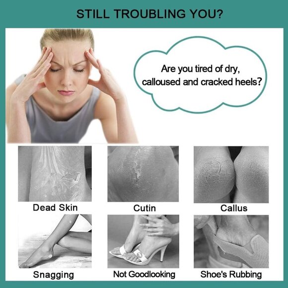 Foot File Callus Remover - Multi Purpose 4 in 1 Feet Pedicure Tools with Foot Sc - Picture 2 of 7